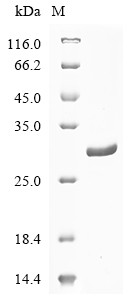 (Tris-Glycine gel) Discontinuous SDS-PAGE (reduced) with 5% enrichment gel and 15% separation gel.