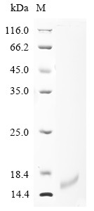 (Tris-Glycine gel) Discontinuous SDS-PAGE (reduced) with 5% enrichment gel and 15% separation gel.