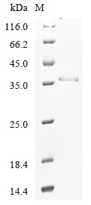 (Tris-Glycine gel) Discontinuous SDS-PAGE (reduced) with 5% enrichment gel and 15% separation gel.
