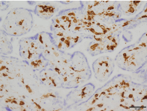Anti Macrophage Scavenger Receptor 1 (MSR1/CD204) mAb (Clone SRA-E5p6)