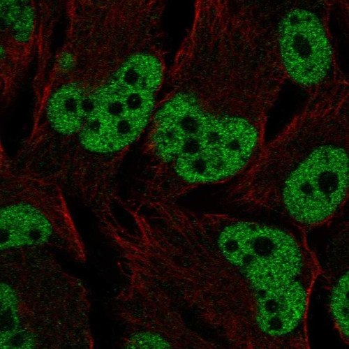 Immunofluorescent staining of human cell line SK-MEL-30 shows localization to nucleoplasm.