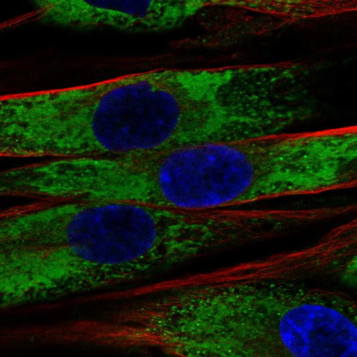 Immunofluorescent staining of human cell line ASC52telo shows localization to endoplasmic reticulum.