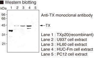 Anti-Caspase-4 (Human) mAb (Clone: 4B9)