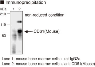 Anti-CD61 (gpIIIa) (Mouse) mAb (Clone: 1-55-4)