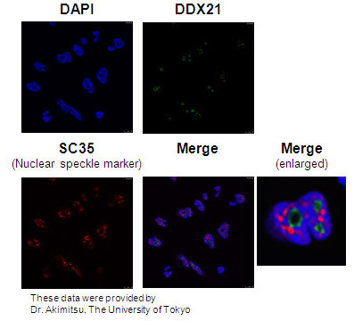 Anti-DDX21 pAb