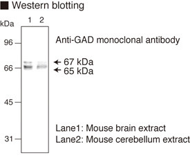 Anti-Glutamic Acid Decarboxylase (GAD) (Human) mAb (Clone: 9A6)
