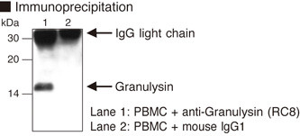 Anti-Granulysin (Human) mAb (Clone: RC8)