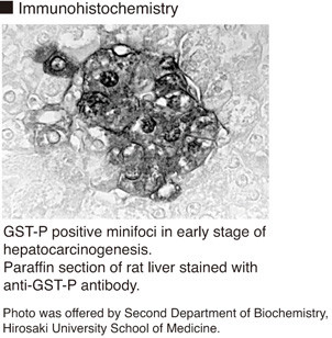 Anti-GST-P (Rat) pAb