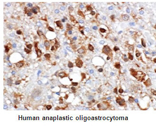 Anti-IDH1-R132S (Human) mAb (Clone: SMab-1)
