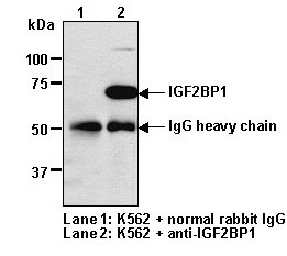 Anti-IGF2BP1 (IMP1) (Human) pAb