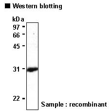 Anti-Neuropsin (Mouse) mAb (Clone: MabB5)