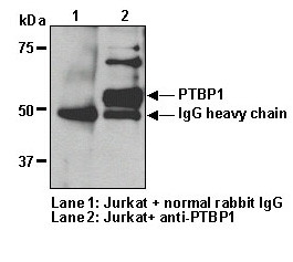 Anti-PTBP1 (Human) pAb