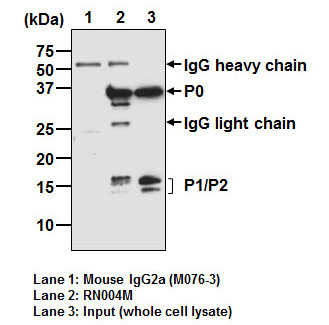 Anti-Ribosomal P0/P1/P2 mAb (Clone: 9D5)