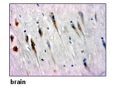 Anti-SLC7A5 (LAT1) (Human) pAb