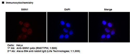 Anti-SMN1 pAb