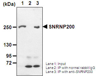 Anti-SNRNP200 pAb