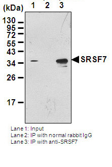 Anti-SRSF7 (9G8) pAb