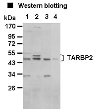 Anti-TARBP2 pAb