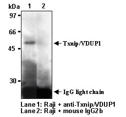 Anti-Txnip (VDUP1) (Human) mAb (Clone: JY1)