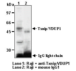 Anti-Txnip (VDUP1) (Human) mAb (Clone: JY2)