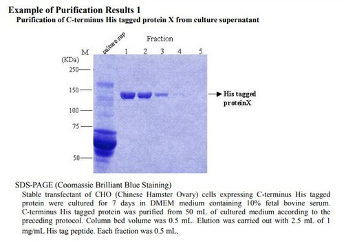 His tagged Protein PURIFICATION GEL