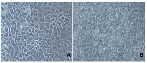 Chondrocytes (rabbit)