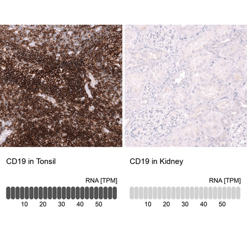 Immunohistochemistry analysis in human tonsil and kidney tissues using AMAb92042 antibody. Corresponding CD19 RNA-seq data are presented for the same tissues.