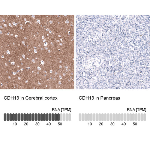 Immunohistochemistry analysis in human cerebral cortex and pancreas tissues using AMAb92034 antibody. Corresponding CDH13 RNA-seq data are presented for the same tissues.
