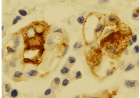 Immunohistochemical detection of proton pump on human stomach paraffin embedded section with D031-3.