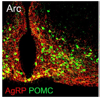 Agouti-related protein pAb (GP)