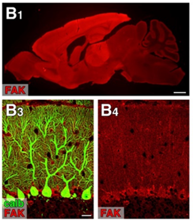FAK (focaladhesionkinase) pAb (Rb)