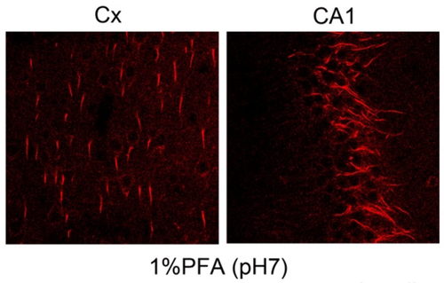 Ank-G (Ankirin-G) pAb (GP)
