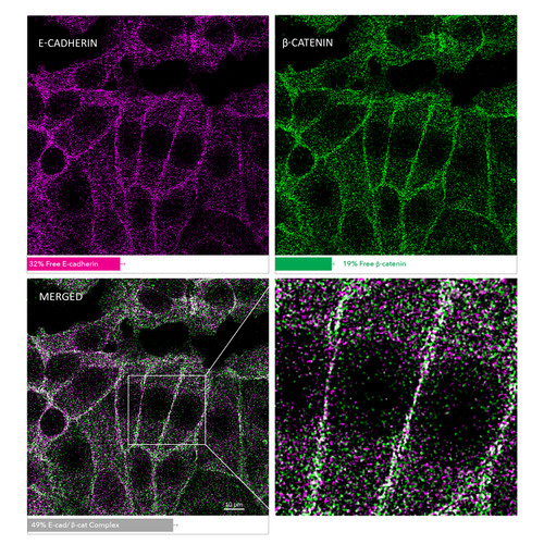 MolBoolean analysis of the interaction between E-cadherin (cat. AMAb90862, magenta) and β-catenin (cat. HPA029159, green) in MCF7 cells, showing the relative quantification of free versus interacting protein fractions, indicated by the detection of rolling circle products (RCPs) in either one or two fluorescent channels. Data is normalized to total target protein levels (total RCPs).