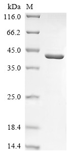 Recombinant Human Ceroid-lipofuscinosis neuronal protein 5 (CLN5) (CSB-EP005567HUc7)
