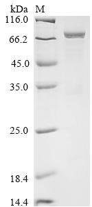 Recombinant Human Eosinophil peroxidase (EPX) (CSB-EP007756HU)