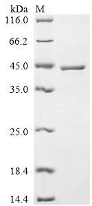 Recombinant Human Estradiol 17-beta-dehydrogenase 1 (HSD17B1) (CSB-EP010766HU)