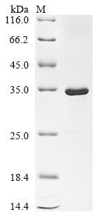 Recombinant Escherichia phage T7 T7 RNA polymerase (1), partial (CSB-EP018353EEB)