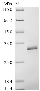 Recombinant Hepatitis B virus genotype A2 subtype adw2 Capsid protein (C) (CSB-EP314434HDO)