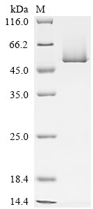 Recombinant Arabidopsis thaliana TATA-box-binding protein 1 (TBP1) (CSB-EP329782DOA)