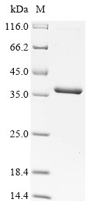 Recombinant Autographa californica nuclear polyhedrosis virus Uncharacterized 30.6 kDa protein in IAP2-VLF1 intergenic region (CSB-EP336861ARA)