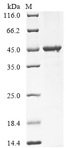 Recombinant Bacteroides fragilis Fragilysin (btfP) (CSB-EP346537BDPa0)