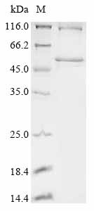 Recombinant Human Ankyrin repeat and SOCS box protein 11 (ASB11) (CSB-EP855501HU)