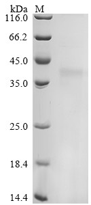 Recombinant Felis catus (Cat) Creatine kinase (CKM), partial (CSB-YP3993CA)