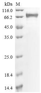 Recombinant Human Desmoglein-3 (DSG3), partial (CSB-MP007205HUc7)