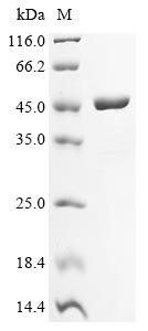 Recombinant Francisella tularensis subsp. novicida Succinyl-CoA ligase [ADP-forming] subunit beta (sucC) (CSB-EP022917FDW)