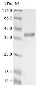 Recombinant Aquifex aeolicus Reverse gyrase 2 (rgy2), partial (CSB-EP524126DNV)