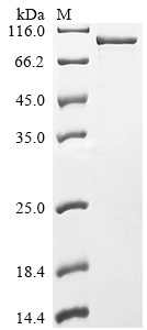 Recombinant Human Cholesteryl ester transfer protein (CETP) (CSB-EP005267HUd8)