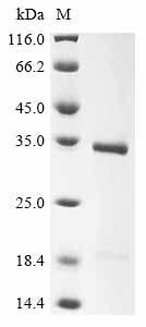 Recombinant Bovine Butyrophilin subfamily 1 member A1 (BTN1A1), partial (CSB-EP002869BO1)