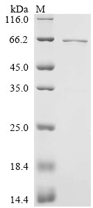 Recombinant Human Early activation antigen CD69 (Cd69), partial, Biotinylated (CSB-EP004952HU-B)