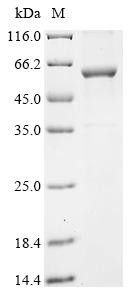 Recombinant Human Cytochrome P450 2A13 (CYP2A13) (CSB-EP621969HU)